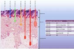 infrared light therapy for hair scalp