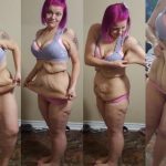 How Much Does Skin Weight After Weight Loss