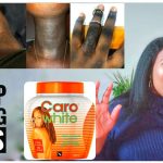 What Happens When You Stop Using Caro White?