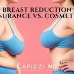 do breast reductions come with a lift