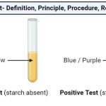 Iodine-Test-Definition-Principle-Procedure-Result-Uses