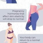 when is the best time to get a tummy tuck