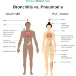 an-infographic-showing-the-symptoms-of-bronchitis-vs-pneumonia